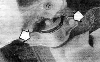 14.9b. Монтажные обоймы задней стойки крепятся к панели пола двумя болтами (показаны стрелками)